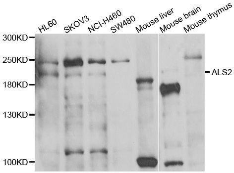 Western blot - ALS2 antibody (144-07125)