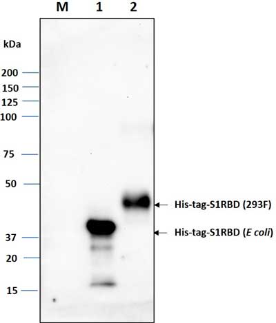 Western blot image