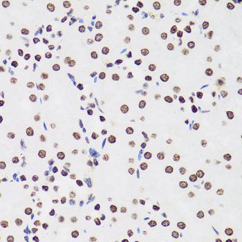 Immunohistochemistry - H1F0 Polyclonal Antibody (144-03298)