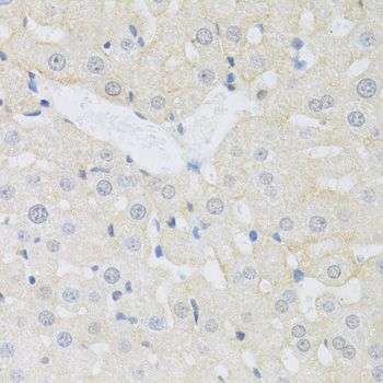 Immunohistochemistry - SLC3A2 antibody (144-05702)
