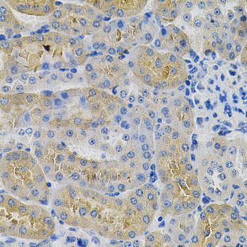 Immunohistochemistry - ANGPTL3 Polyclonal Antibody (144-00689)