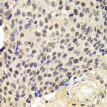 Immunohistochemistry - KPNA1 antibody (144-01742)