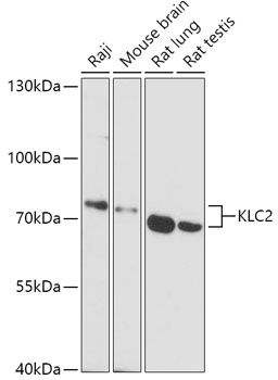 Western blot