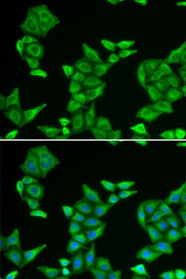 Western blot - COX5A Polyclonal Antibody (144-06437)