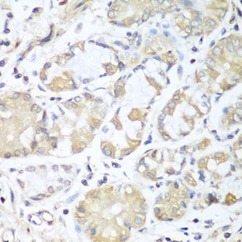 Immunohistochemistry - RPH3AL antibody (144-04311)