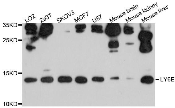 Western blot - LY6E Polyclonal Antibody (144-600525)