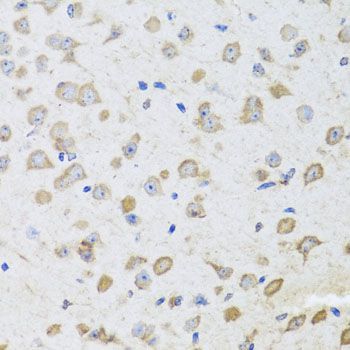 Immunohistochemistry - ARL6 antibody (144-08269)