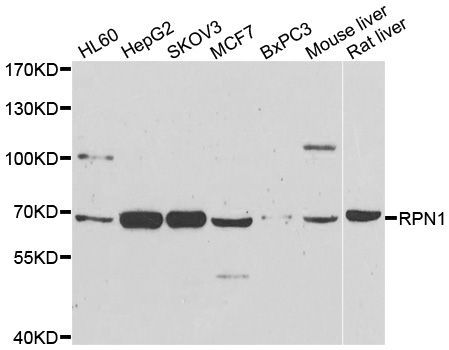Western blot - RPN1 antibody (144-600827)