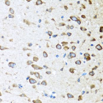 Immunohistochemistry - ACVR1C Polyclonal Antibody (144-00678)