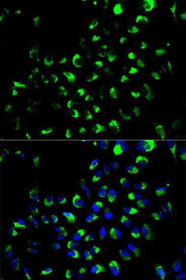 Immunofluorescence - AK4 Polyclonal Antibody (144-603441)