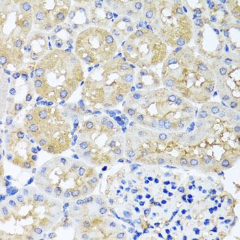 Immunohistochemistry - HARS2 antibody (144-07785)
