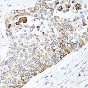 Immunohistochemistry - PPOX Polyclonal Antibody (144-06397)