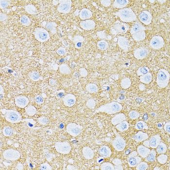 Immunohistochemistry - SLC1A2 Polyclonal Antibody (144-00910)