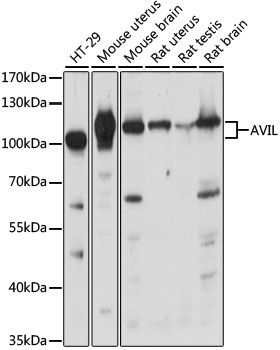 Western blot - AVIL antibody (144-015785)