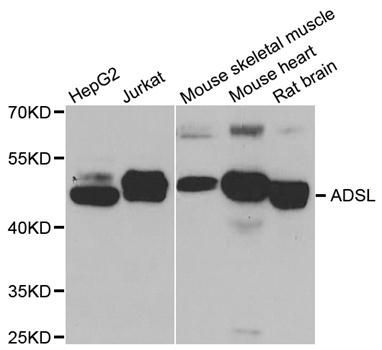 Western blot - ADSL Polyclonal Antibody (144-06278)