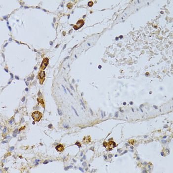 Immunohistochemistry - PHGDH Polyclonal Antibody (144-10461)