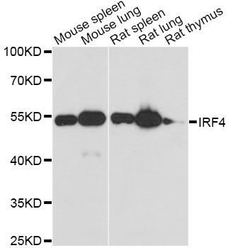 Western blot - IRF4 Polyclonal Antibody (144-00524)
