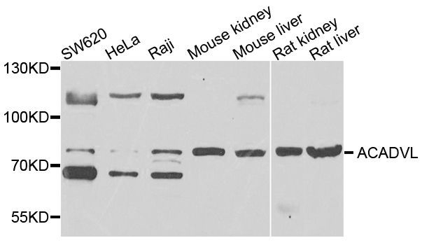 Western blot - ACADVL Polyclonal Antibody (144-07865)