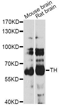 Western blot - TH Polyclonal Antibody (144-00028)