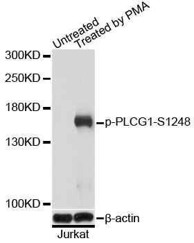 Western blot - Phospho-PLCG1-S1248 pAb (144-61540)