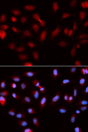 Immunofluorescence - BIRC5 Polyclonal Antibody (144-01551)