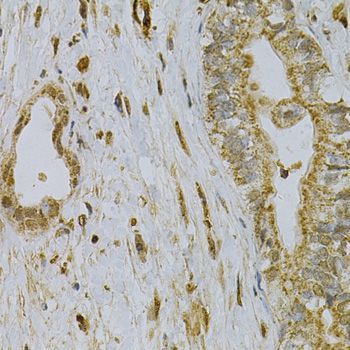 Immunohistochemistry - CDA Polyclonal Antibody (144-013959)