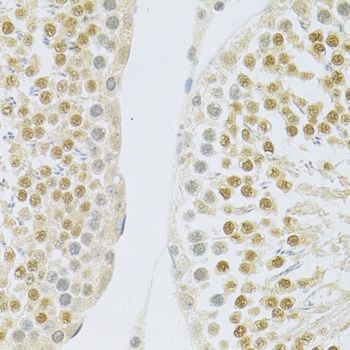 Immunohistochemistry - SLC39A7 antibody (144-03343)