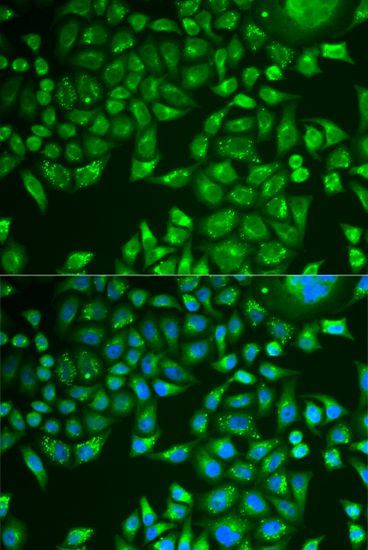 Immunofluorescence - PNLIP Polyclonal Antibody (144-07421)