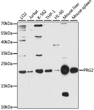Western blot - PRG2 antibody (144-61345)