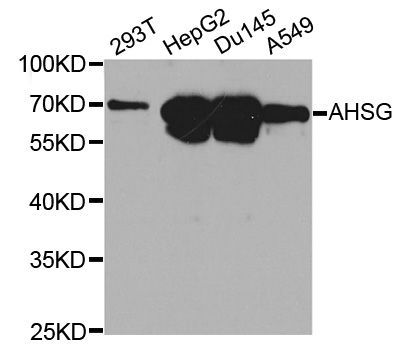 Western blot - AHSG antibody (144-01647)