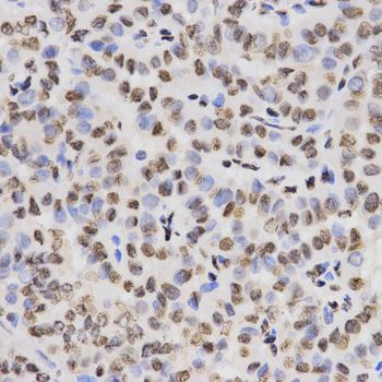 Immunohistochemistry - TriMethyl-Histone H3-K27 pAb (144-02363)