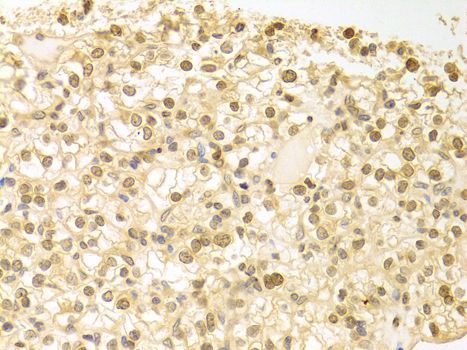 Immunohistochemistry - PLCB1 antibody (144-01971)