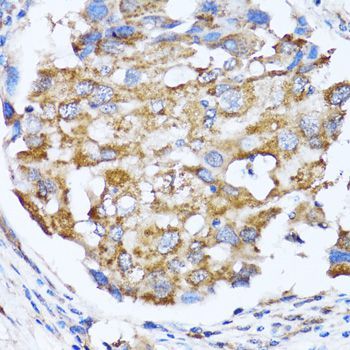 Immunohistochemistry - NDE1 antibody (144-07112)