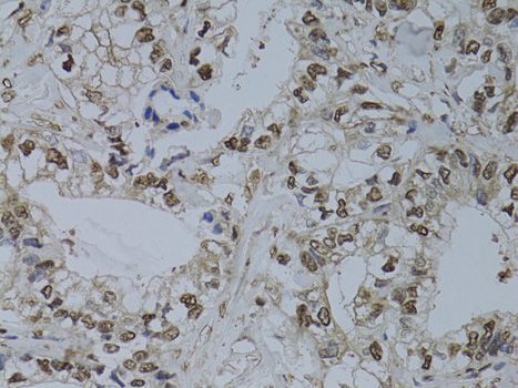 Immunohistochemistry - HUS1 antibody (144-60528)