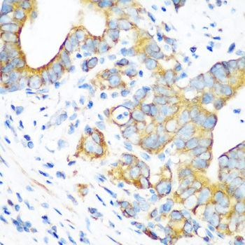 Immunohistochemistry - MT-CO2 antibody (144-011522)