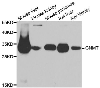 Western blot - GNMT antibody (144-06608)