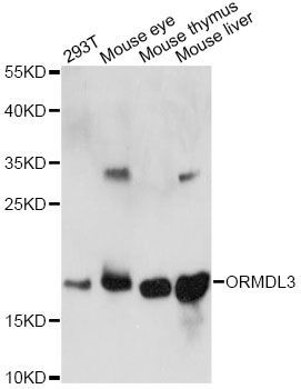 Western blot - ORMDL3 antibody (144-014951)