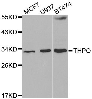 Western blot - THPO antibody (144-01825)