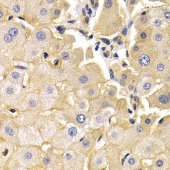 Immunohistochemistry - KLKB1 antibody (144-05318)