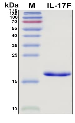 SDS-PAGE Image