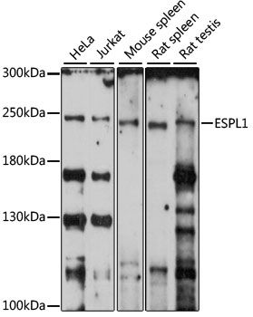 Western blot - ESPL1 antibody (144-61016)