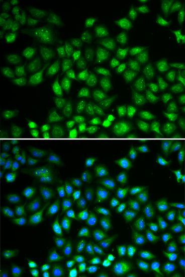 Immunofluorescence - PSMB1 Polyclonal Antibody (144-01043)