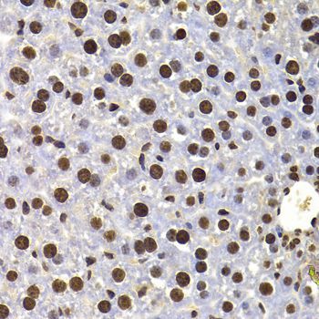 Immunohistochemistry - HIRIP3 antibody (144-07014)
