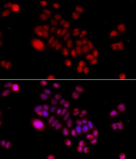 Immunofluorescence - DNAJB6 Polyclonal Antibody (144-07052)