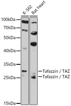 Western blot