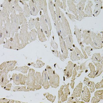 Immunohistochemistry - FGF2 Polyclonal Antibody (144-00235)