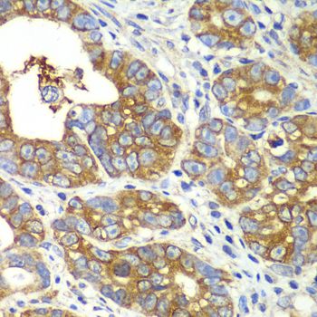 Immunohistochemistry - QARS antibody (144-06960)