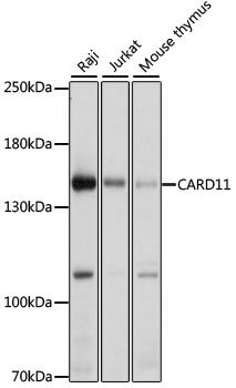 Western blot - CARD11 antibody (144-07140)