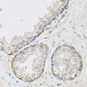 Immunohistochemistry - CIB1 antibody (144-04430)