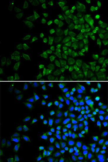 Immunofluorescence - BAK1 Polyclonal Antibody (144-00204)